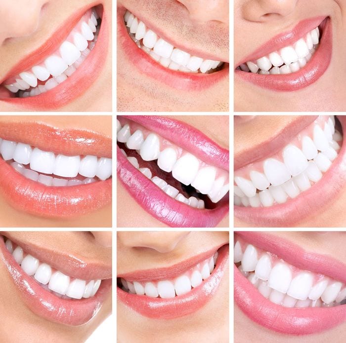 Hollywood & Pembroke Pines Cosmetic Dentistry