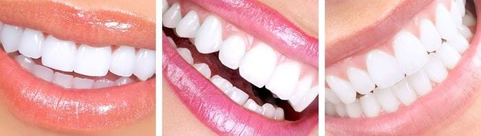 , Cosmetic Dentistry