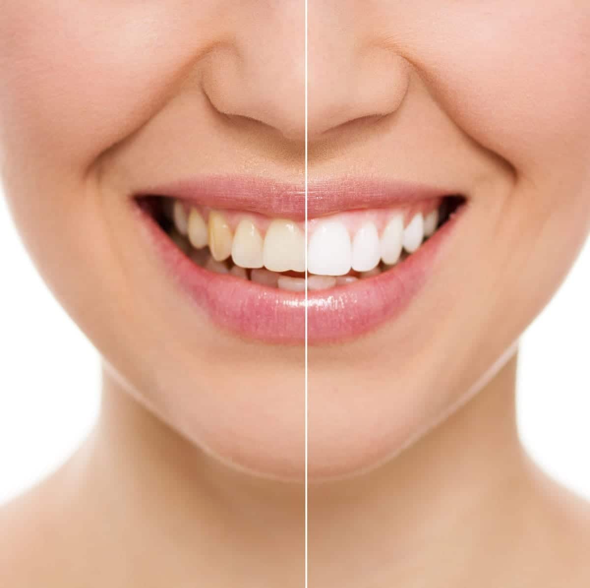 3 Ways to Whiten Your Teeth