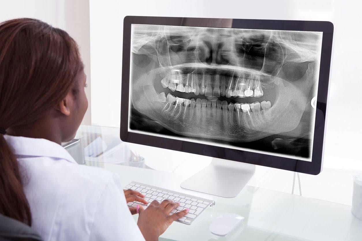 5 Ways Digital Imaging and X-Rays Are Better Today
