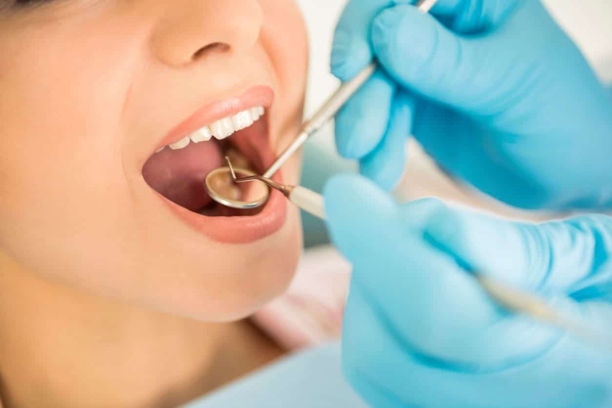 Did You Know Your Trip to the Dentist Can Double as a Cancer Screening