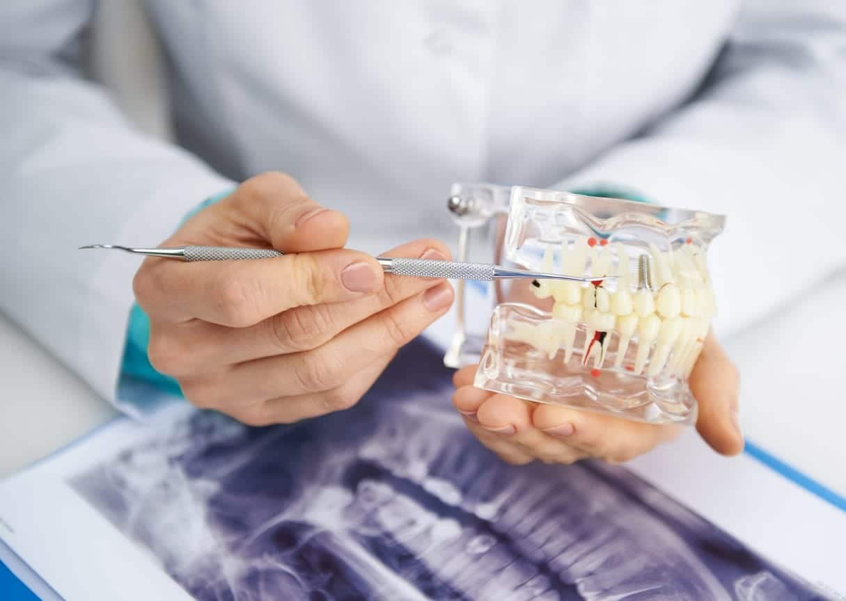 Dentures Hollywood FL