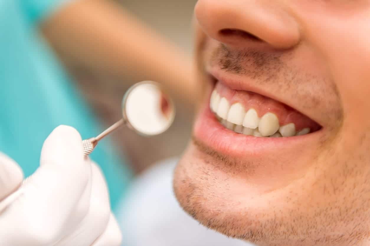 Everything You Need to Know about Full Mouth Rehabilitation