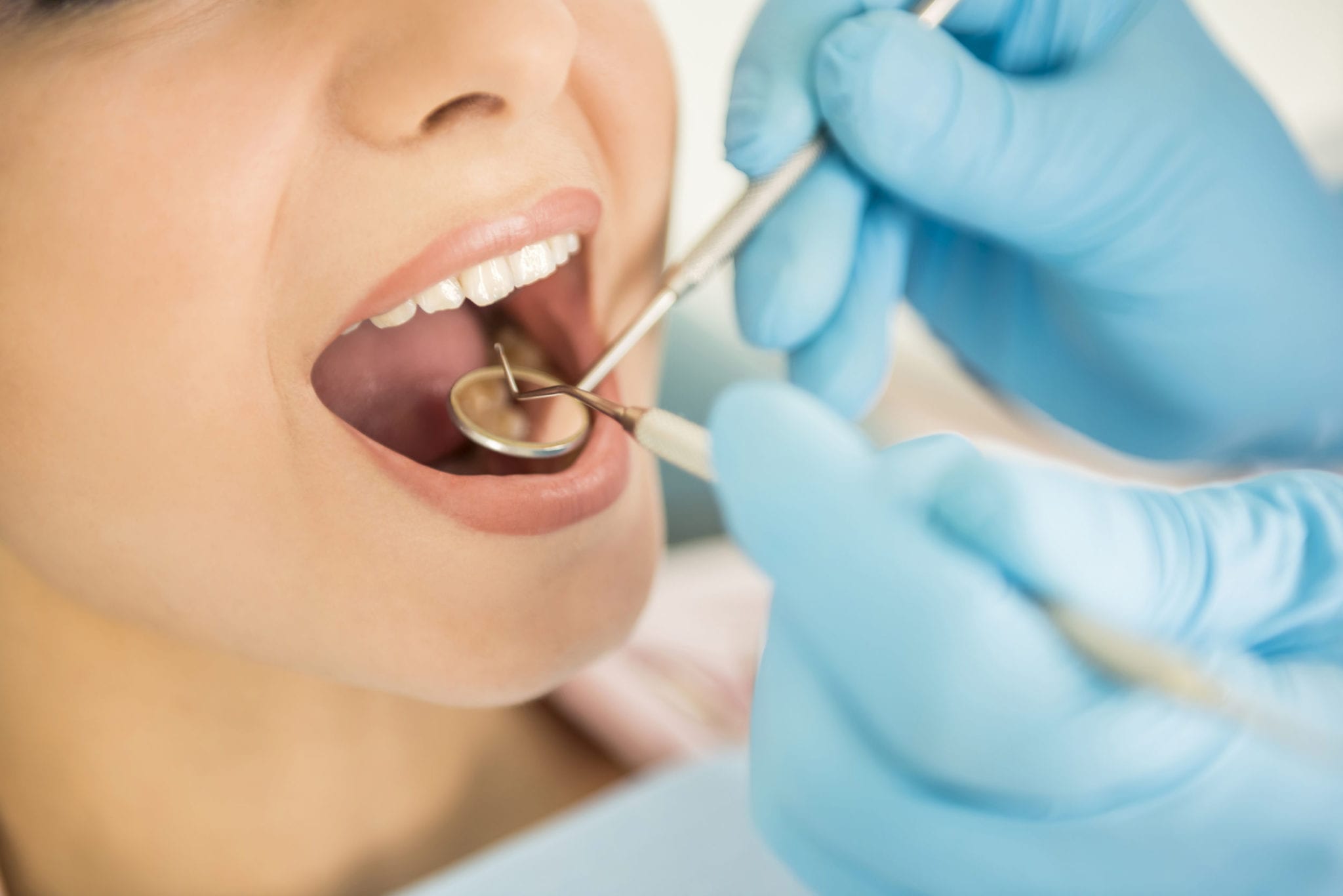 Top 10 Signs You Need to See the Dentist – Now