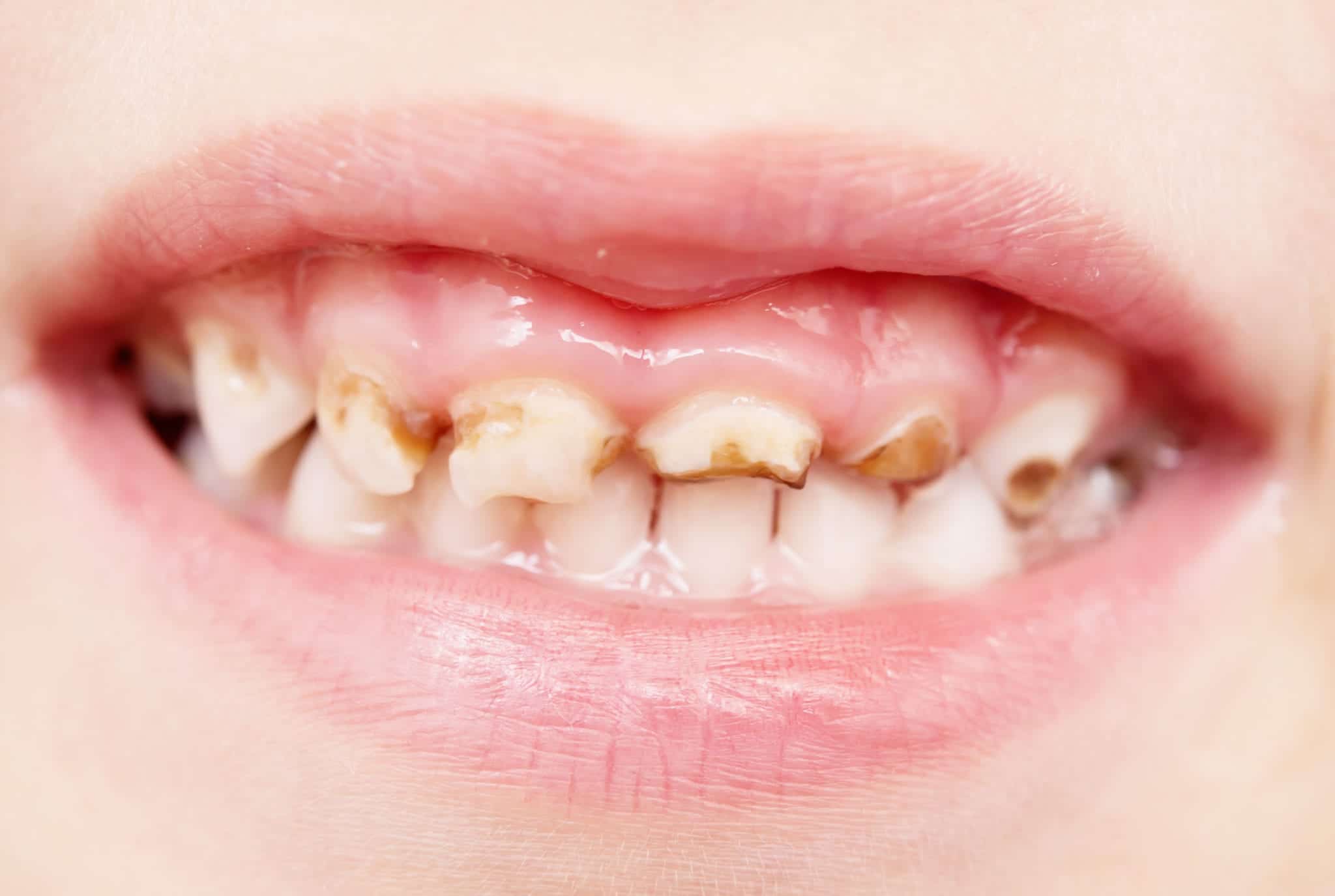 Hollywood FL Dentist
