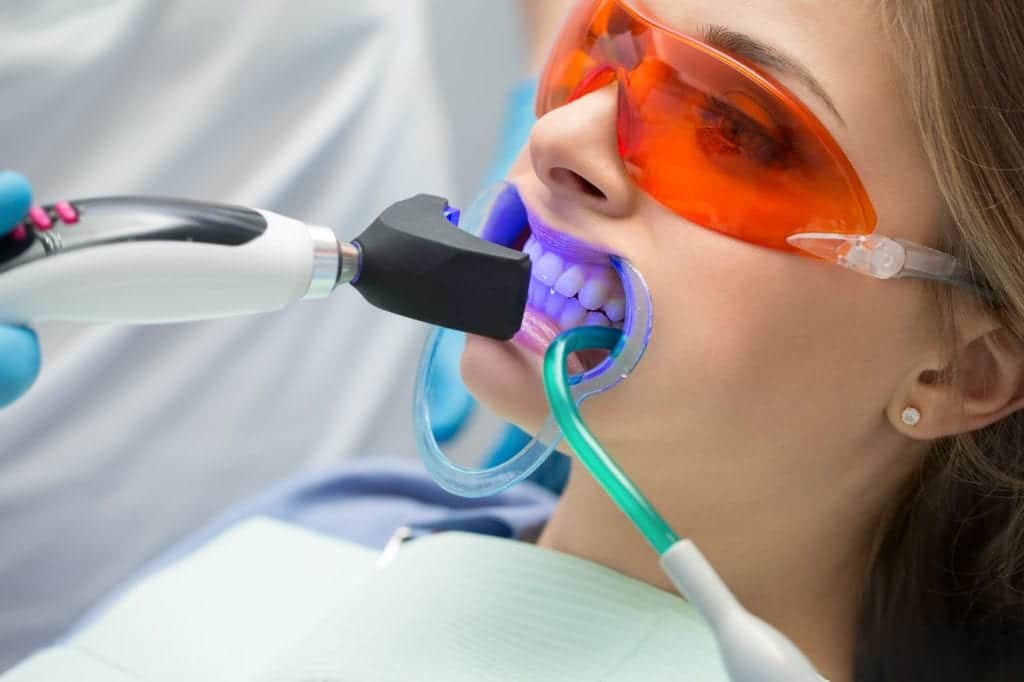 The Vast Difference between Whitening and Tooth Color Restoration
