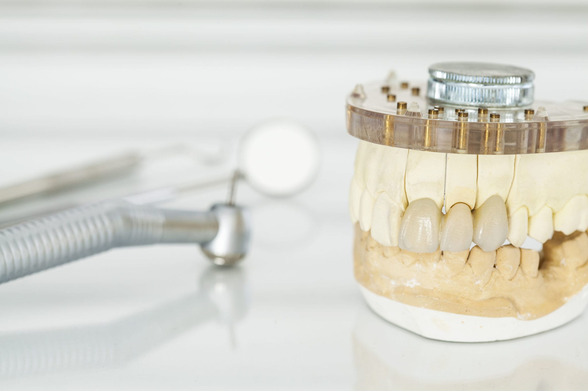 Hollywood FL Tooth Erosion Treatment