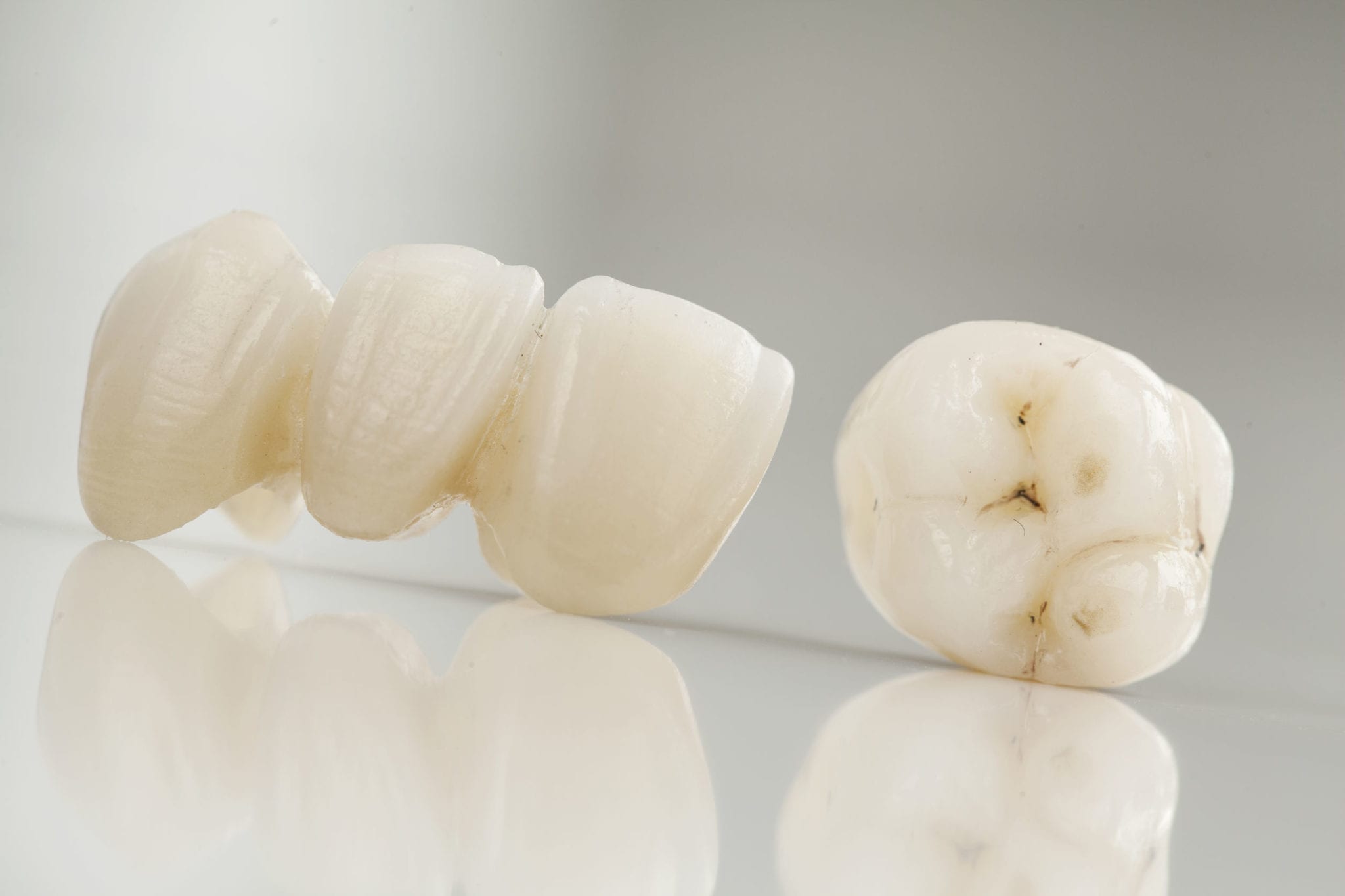 Understanding Dental Bridges: The Types That Are Available