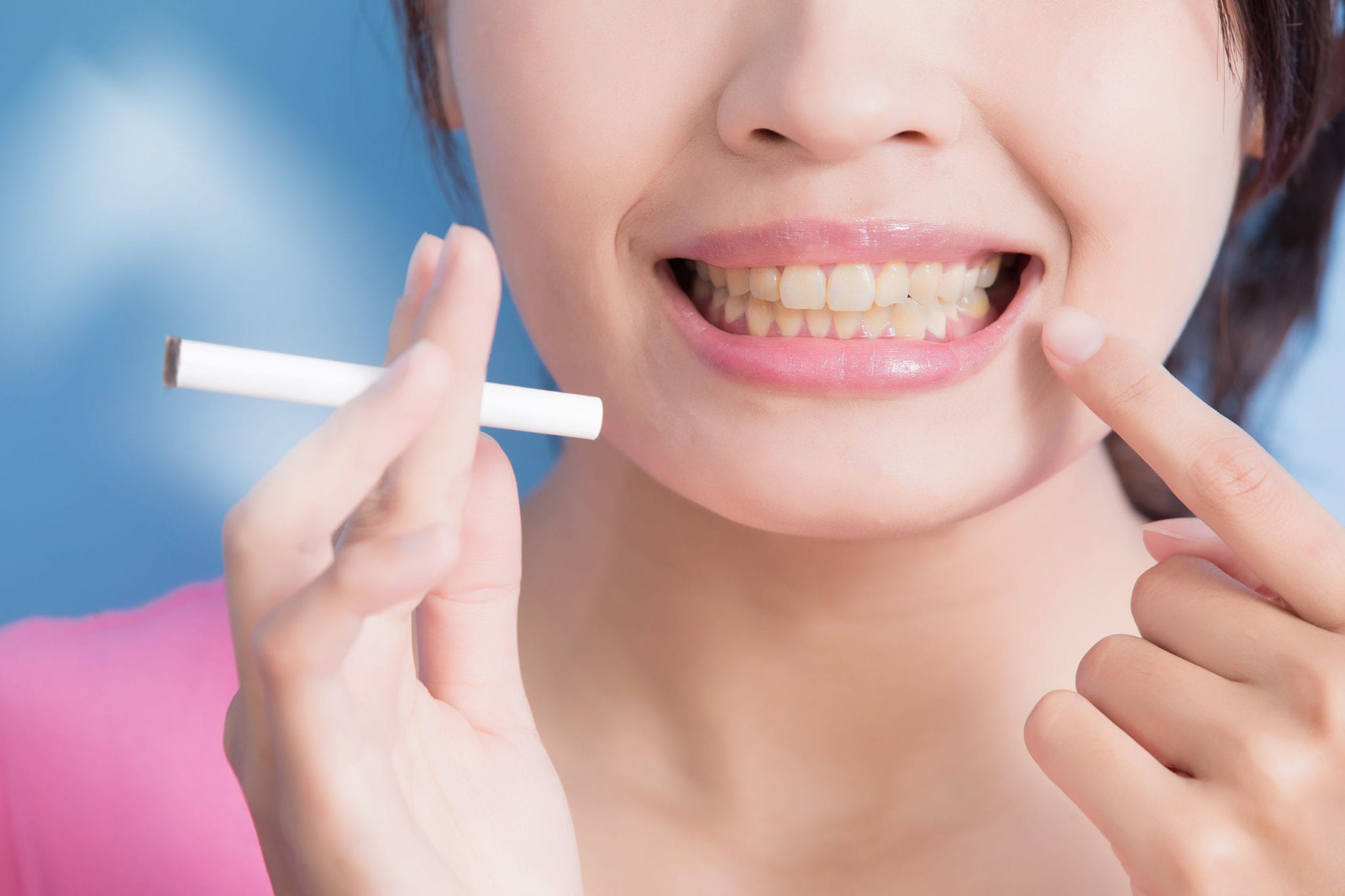 The Many Ways Smoking Is Bad for Your Oral Health