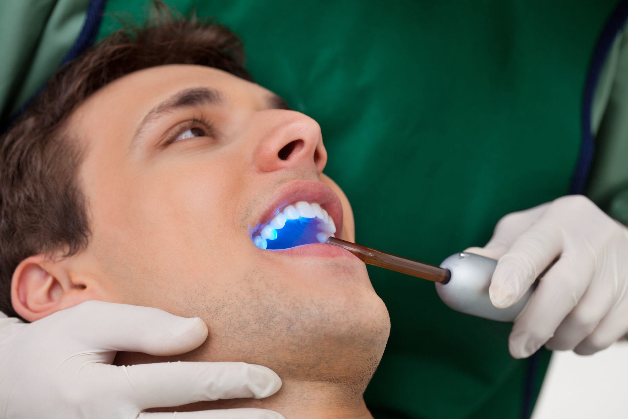Everything You Need to Know about Dental Sealants
