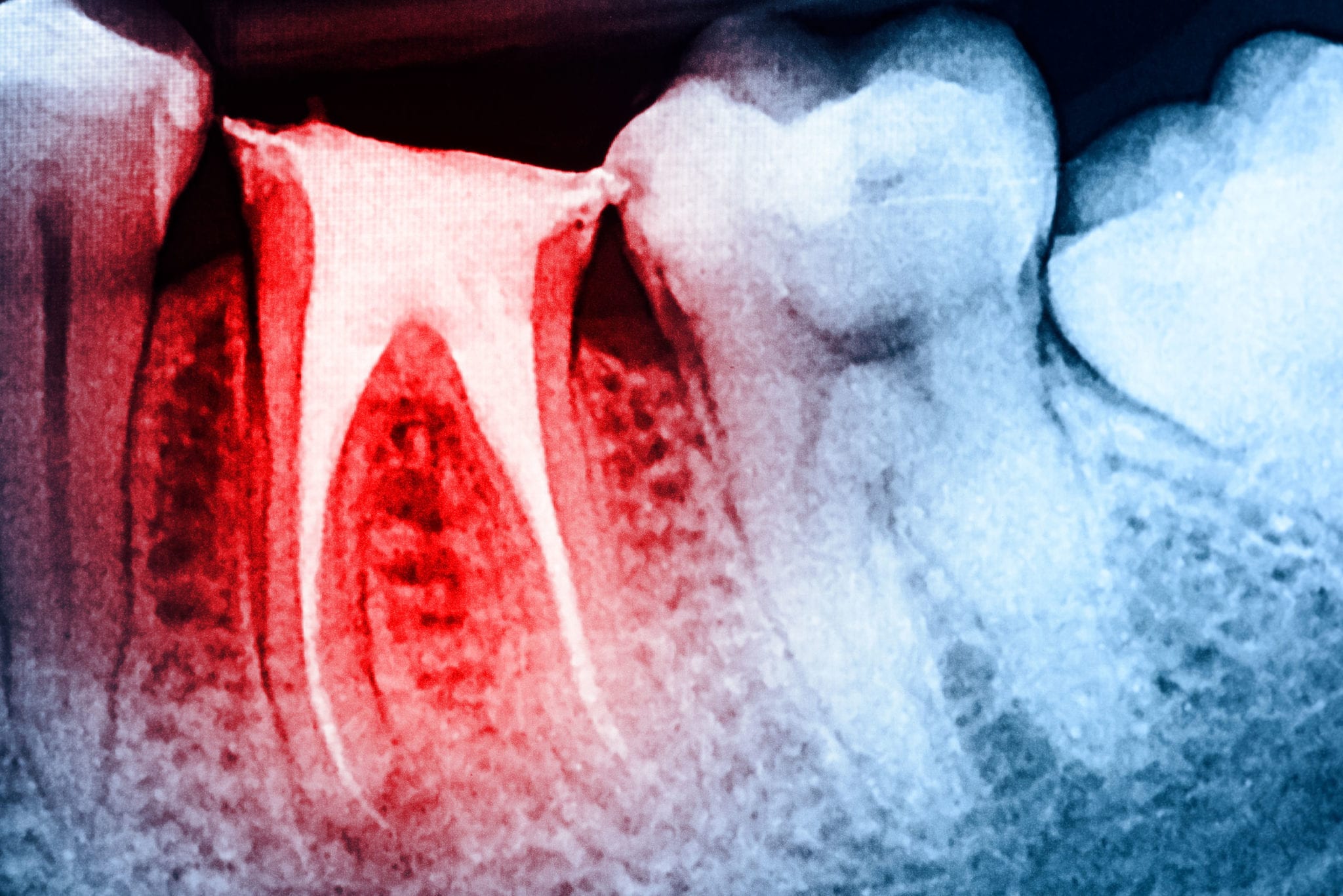 , Regeneracja zębów: The Future of Dentistry