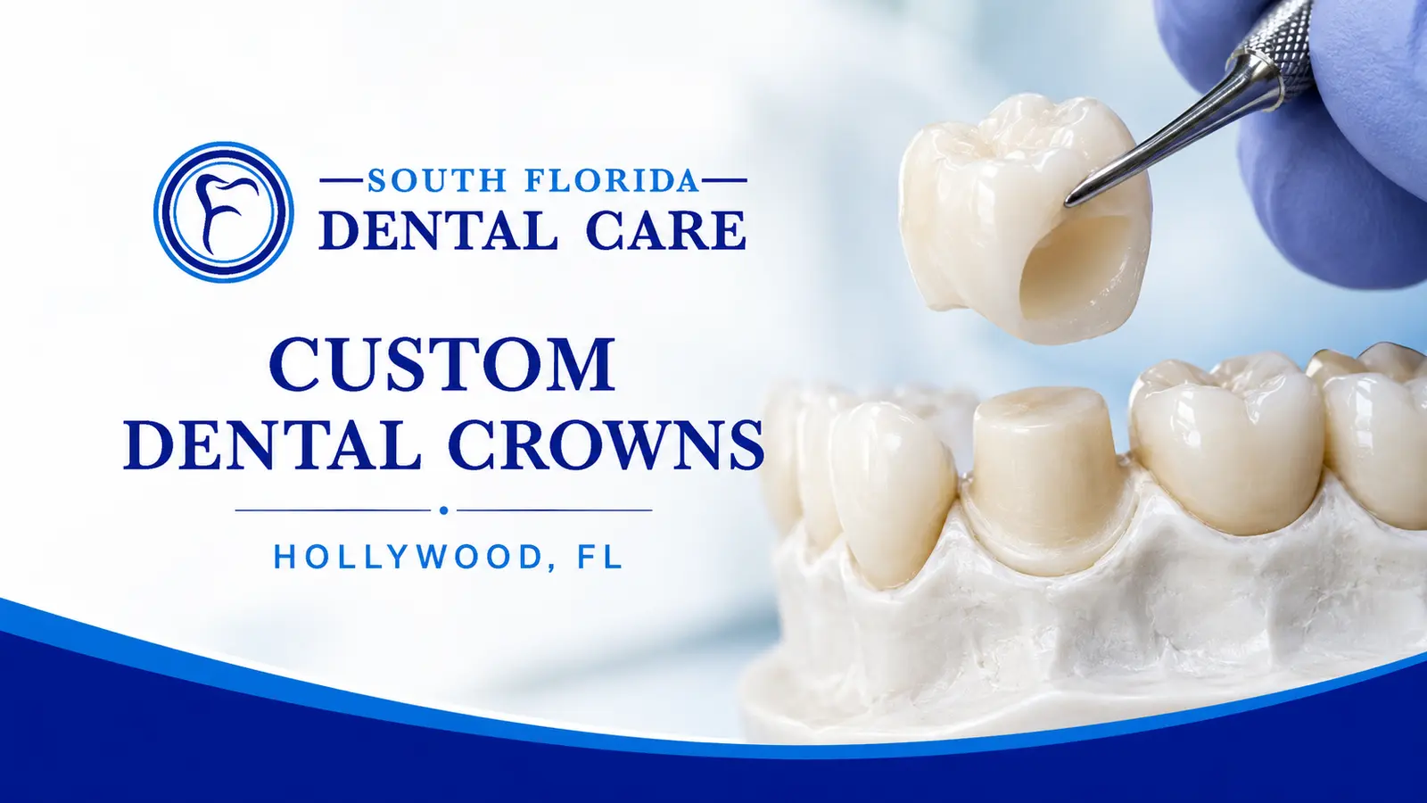 Custom ceramic dental crown at South Florida Dental Care in Hollywood, FL