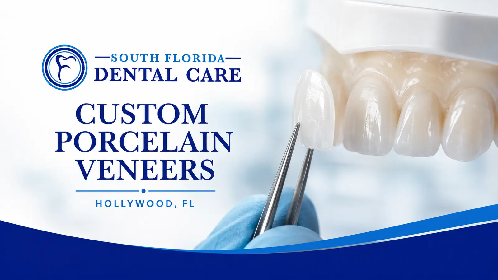 Custom porcelain veneer at South Florida Dental Care in Hollywood, FL