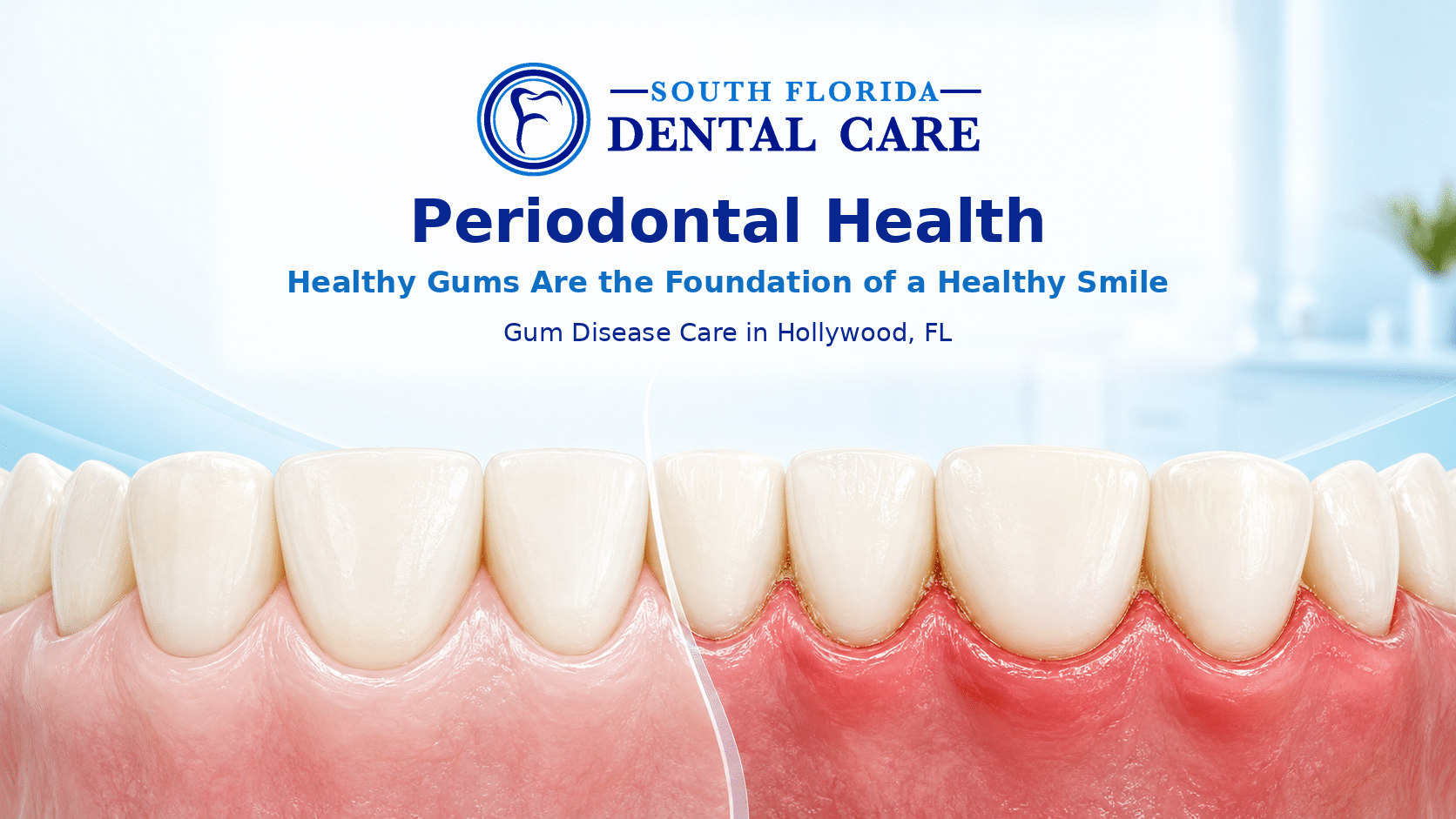 Comparison of healthy gums and inflamed gums for periodontal care in Hollywood, FL